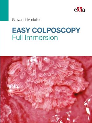 cover image of Easy Colposcopy
